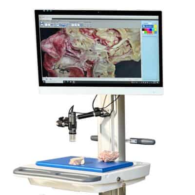 PathCam Gross Imaging System - Image 4